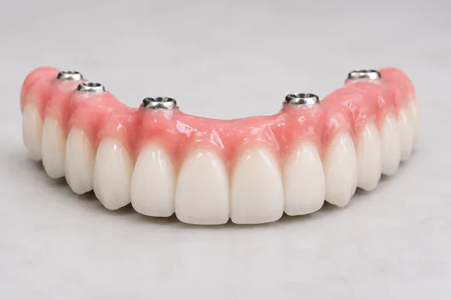 implant supported denture top
