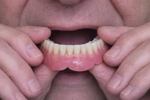 man putting dentures in mouth