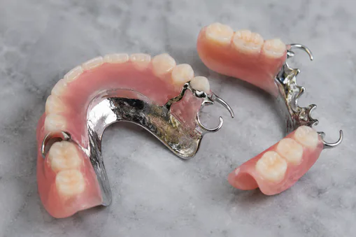 Partial dentures
