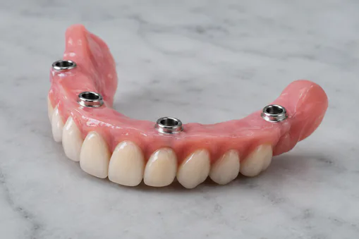 Snap in dentures